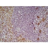 Immunohistochemistry - Anti-CD68 Antibody [FA-11] (A280454) - Antibodies.com