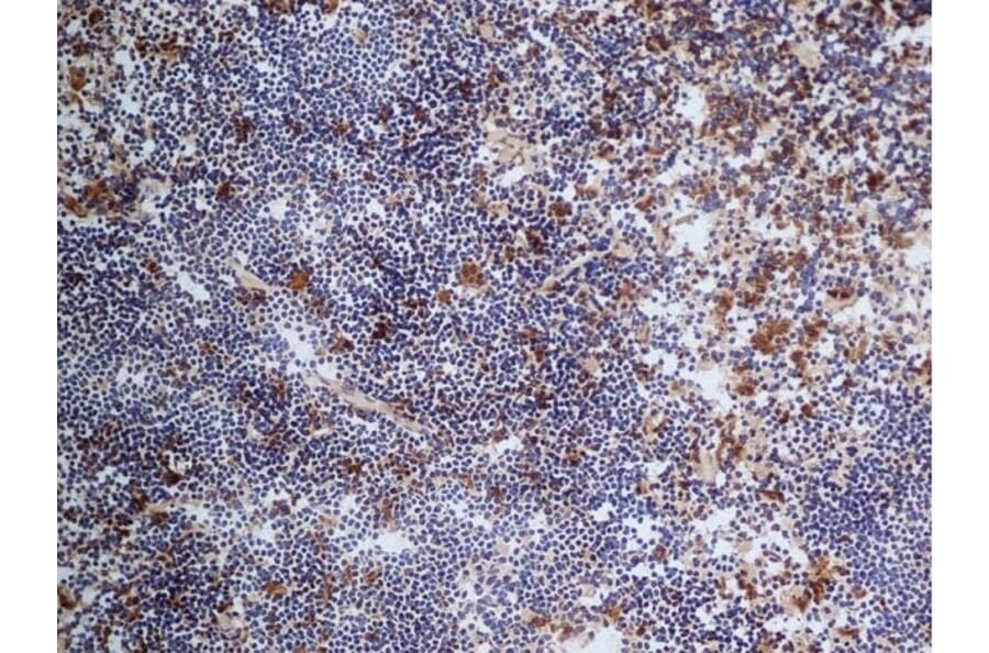Immunohistochemistry - Anti-CD68 Antibody [FA-11] (A280454) - Antibodies.com