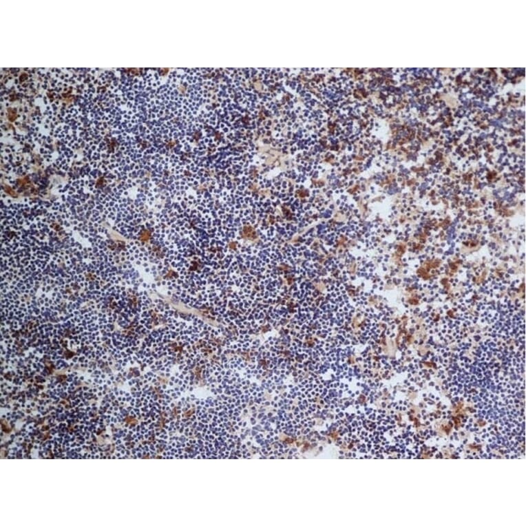 Immunohistochemistry - Anti-CD68 Antibody [FA-11] (A280454) - Antibodies.com