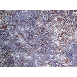 Immunohistochemistry - Anti-CD68 Antibody [FA-11] (A280454) - Antibodies.com