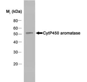 Western Blot - Anti-Aromatase Antibody [H4] (A280555) - Antibodies.com