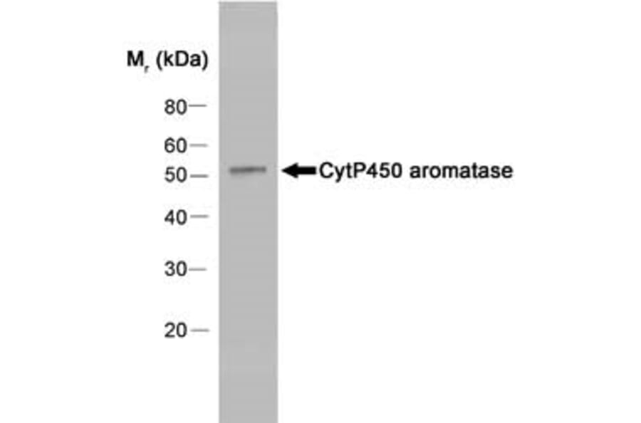 Western Blot - Anti-Aromatase Antibody [H4] (A280555) - Antibodies.com
