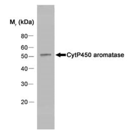 Western Blot - Anti-Aromatase Antibody [H4] (A280555) - Antibodies.com