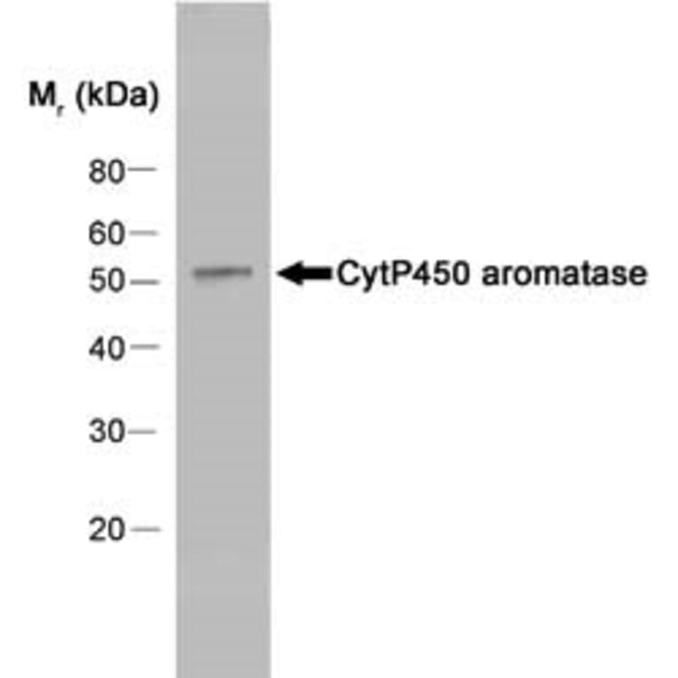 Western Blot - Anti-Aromatase Antibody [H4] (A280555) - Antibodies.com