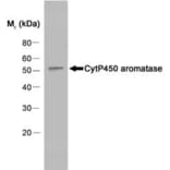 Western Blot - Anti-Aromatase Antibody [H4] (A280555) - Antibodies.com