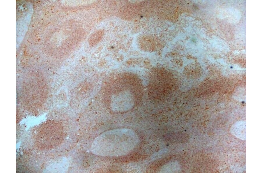 Immunohistochemistry - Anti-CD83 Antibody [HB15e] (A280573) - Antibodies.com