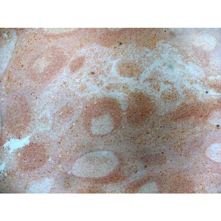 Immunohistochemistry - Anti-CD83 Antibody [HB15e] (A280573) - Antibodies.com