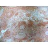 Immunohistochemistry - Anti-CD83 Antibody [HB15e] (A280573) - Antibodies.com