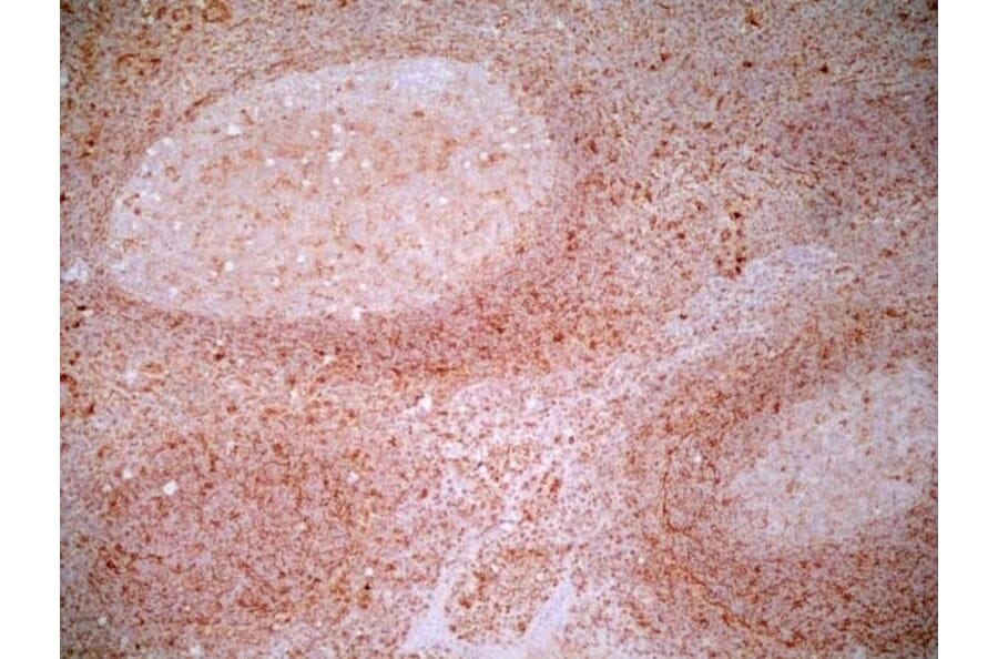 Immunohistochemistry - Anti-CD83 Antibody [HB15e] (A280573) - Antibodies.com