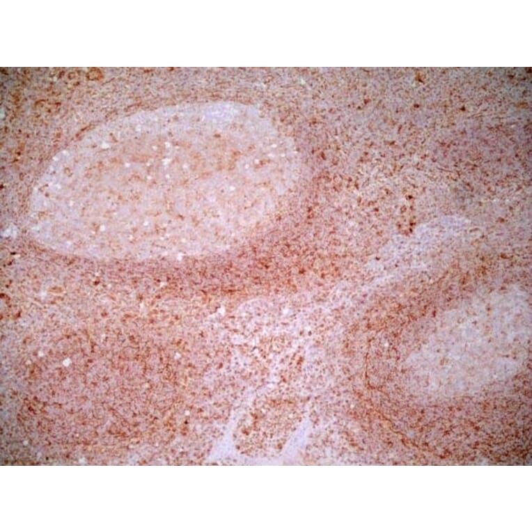 Immunohistochemistry - Anti-CD83 Antibody [HB15e] (A280573) - Antibodies.com