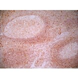 Immunohistochemistry - Anti-CD83 Antibody [HB15e] (A280573) - Antibodies.com