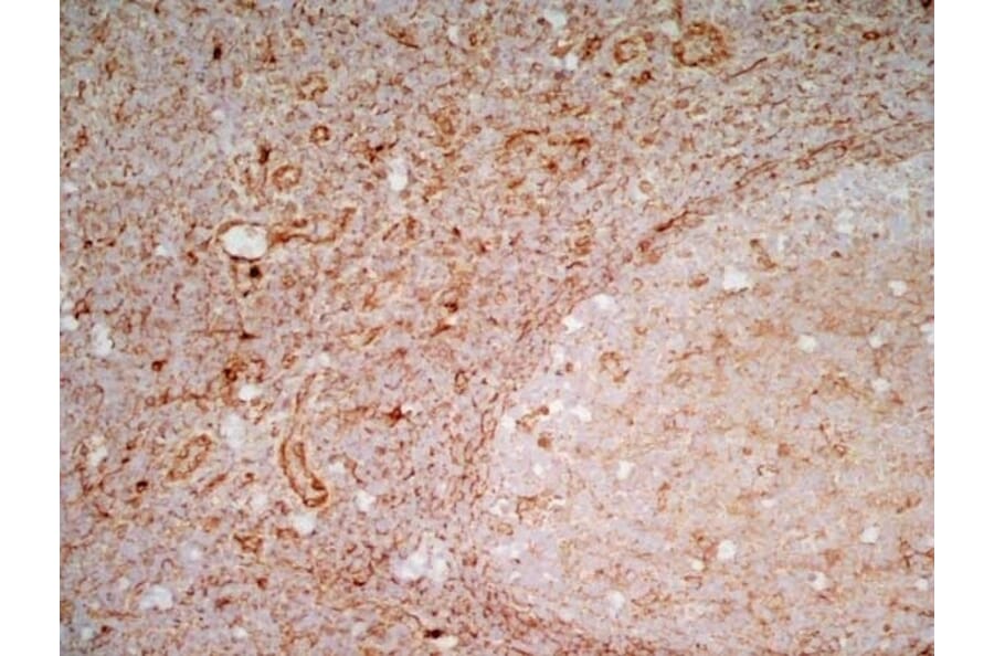 Immunohistochemistry - Anti-CD83 Antibody [HB15e] (A280573) - Antibodies.com