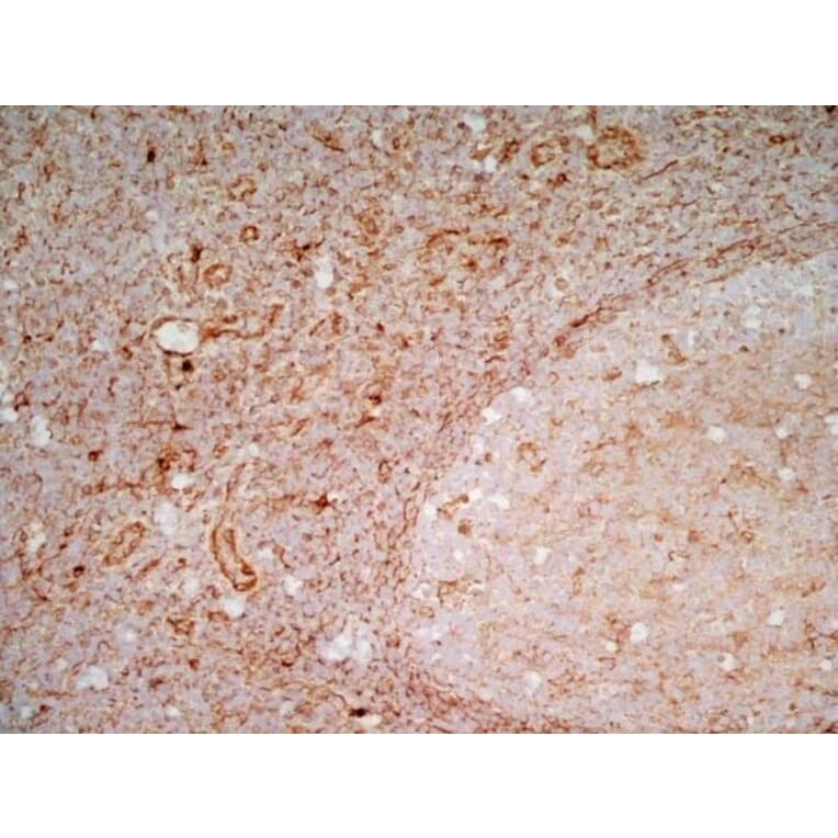 Immunohistochemistry - Anti-CD83 Antibody [HB15e] (A280573) - Antibodies.com