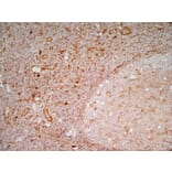 Immunohistochemistry - Anti-CD83 Antibody [HB15e] (A280573) - Antibodies.com