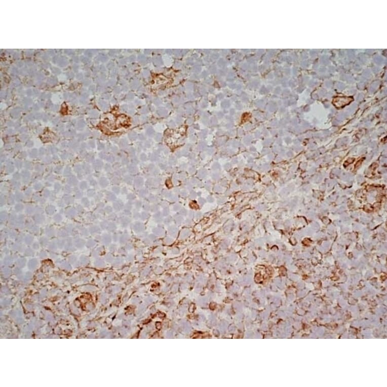 Immunohistochemistry - Anti-CD83 Antibody [HB15e] (A280573) - Antibodies.com