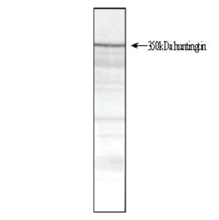 Western Blot - Anti-Huntingtin Antibody [HDB4E10] (A280584) - Antibodies.com