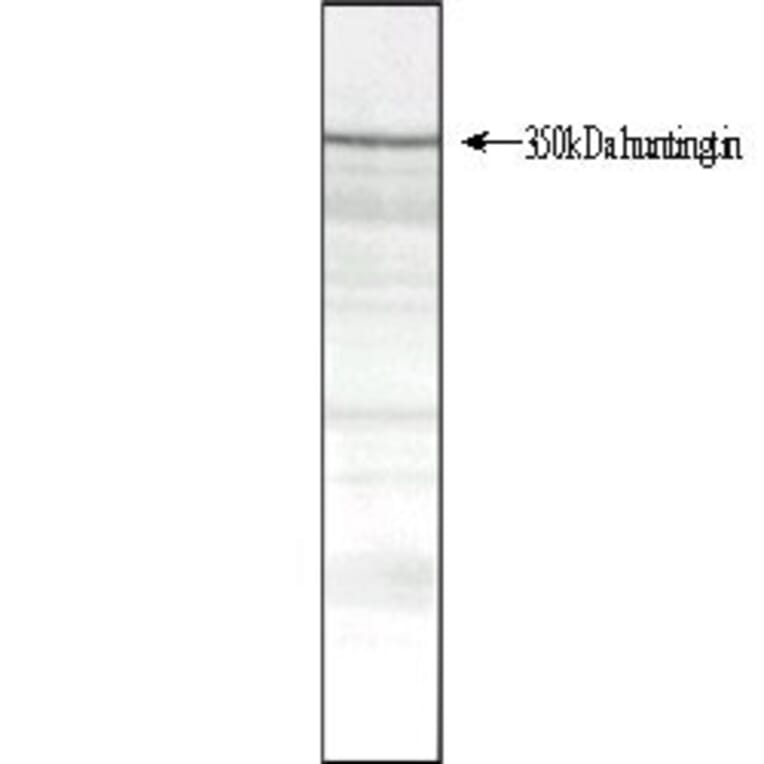 Western Blot - Anti-Huntingtin Antibody [HDB4E10] (A280584) - Antibodies.com