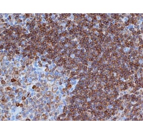 Flow Cytometry - Anti-CD79a Antibody [HM57] (A280617) - Antibodies.com