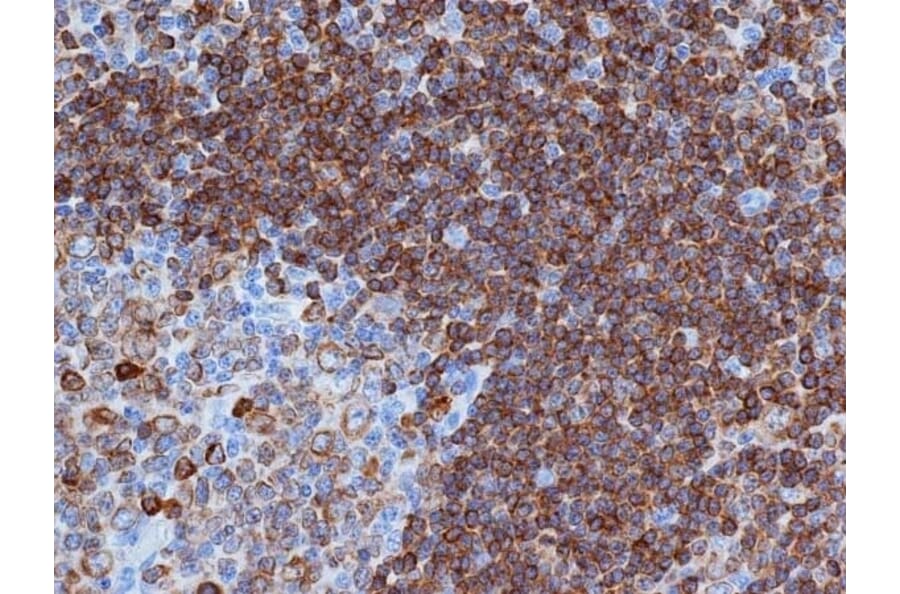 Flow Cytometry - Anti-CD79a Antibody [HM57] (A280617) - Antibodies.com