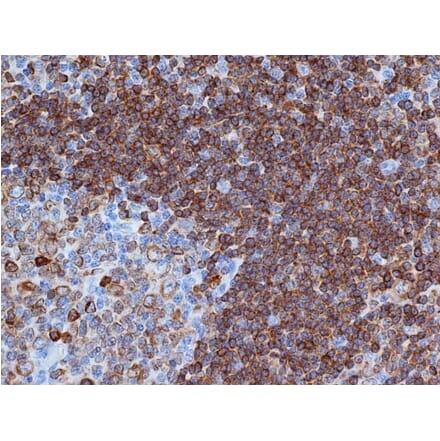 Flow Cytometry - Anti-CD79a Antibody [HM57] (A280617) - Antibodies.com
