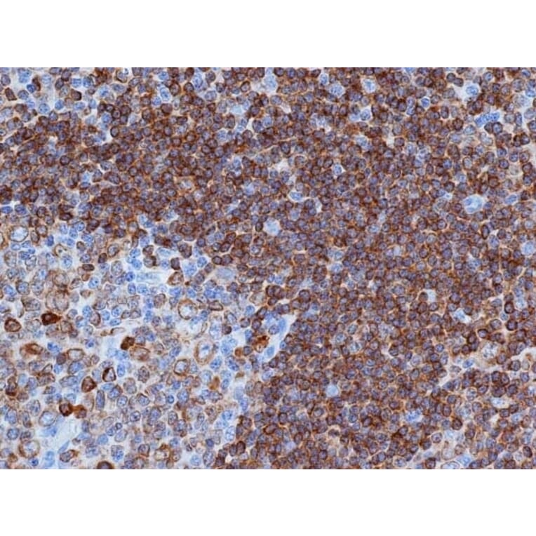 Flow Cytometry - Anti-CD79a Antibody [HM57] (A280617) - Antibodies.com