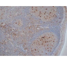 Immunohistochemistry - Anti-CD68 Antibody [KP1] (A280823) - Antibodies.com