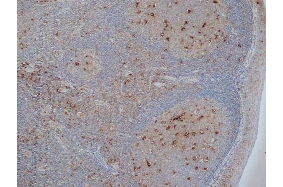 Immunohistochemistry - Anti-CD68 Antibody [KP1] (A280823) - Antibodies.com