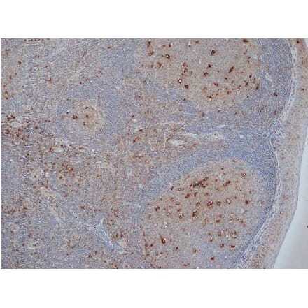 Immunohistochemistry - Anti-CD68 Antibody [KP1] (A280823) - Antibodies.com