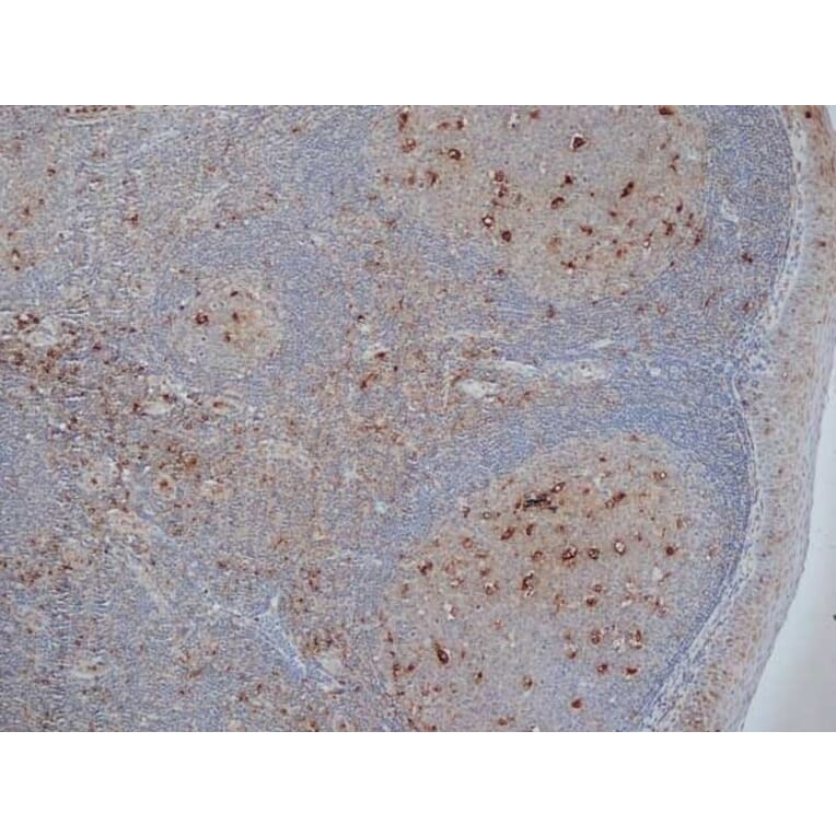 Immunohistochemistry - Anti-CD68 Antibody [KP1] (A280823) - Antibodies.com