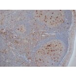 Immunohistochemistry - Anti-CD68 Antibody [KP1] (A280823) - Antibodies.com
