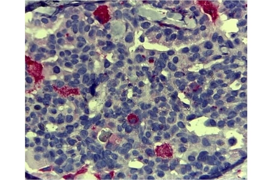 Immunohistochemistry - Anti-CD68 Antibody [KP1] (A280823) - Antibodies.com