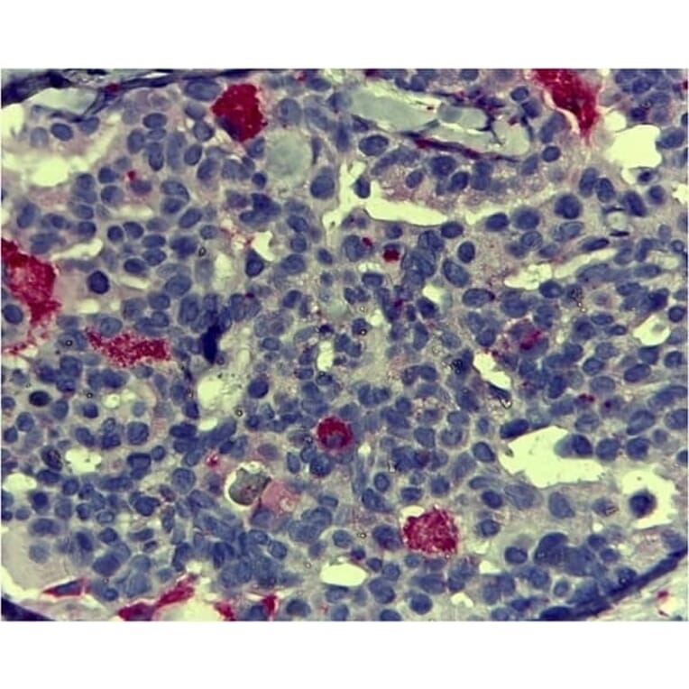 Immunohistochemistry - Anti-CD68 Antibody [KP1] (A280823) - Antibodies.com