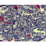 Immunohistochemistry - Anti-CD68 Antibody [KP1] (A280823) - Antibodies.com