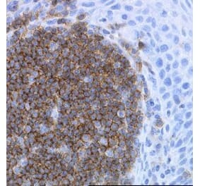 Immunohistochemistry - Anti-CD19 Antibody [LE-CD19] (A280867) - Antibodies.com