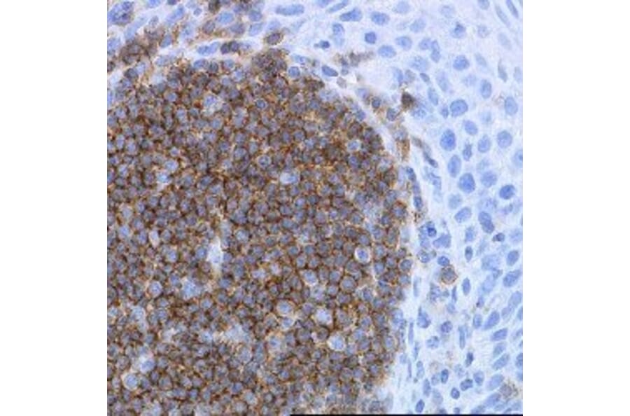 Immunohistochemistry - Anti-CD19 Antibody [LE-CD19] (A280867) - Antibodies.com