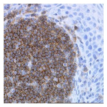 Immunohistochemistry - Anti-CD19 Antibody [LE-CD19] (A280867) - Antibodies.com