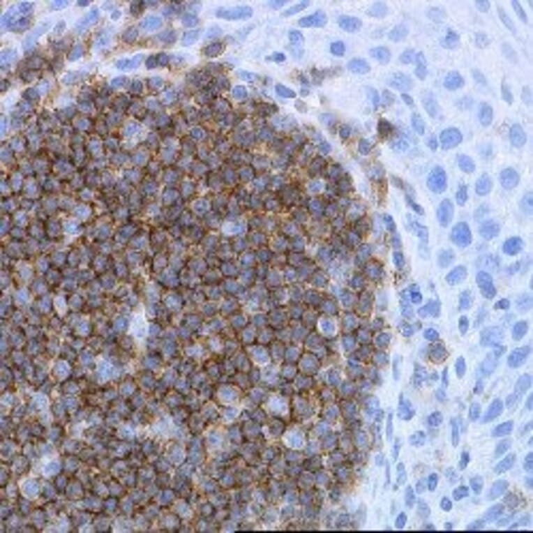 Immunohistochemistry - Anti-CD19 Antibody [LE-CD19] (A280867) - Antibodies.com