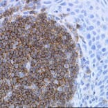 Immunohistochemistry - Anti-CD19 Antibody [LE-CD19] (A280867) - Antibodies.com