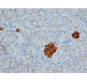 Immunohistochemistry - Anti-Chromogranin A Antibody [LK2H10] (A280876) - Antibodies.com
