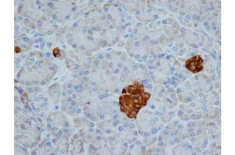Immunohistochemistry - Anti-Chromogranin A Antibody [LK2H10] (A280876) - Antibodies.com
