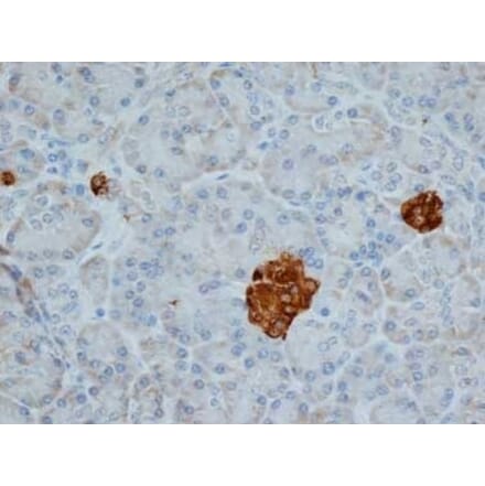 Immunohistochemistry - Anti-Chromogranin A Antibody [LK2H10] (A280876) - Antibodies.com
