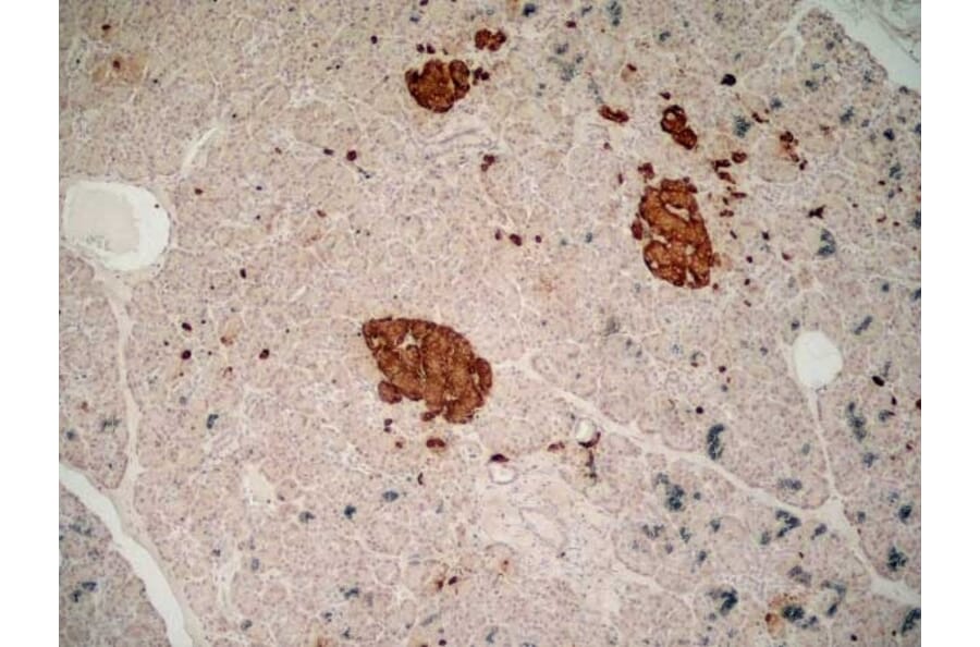 Immunohistochemistry - Anti-Chromogranin A Antibody [LK2H10] (A280876) - Antibodies.com