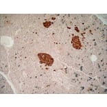 Immunohistochemistry - Anti-Chromogranin A Antibody [LK2H10] (A280876) - Antibodies.com