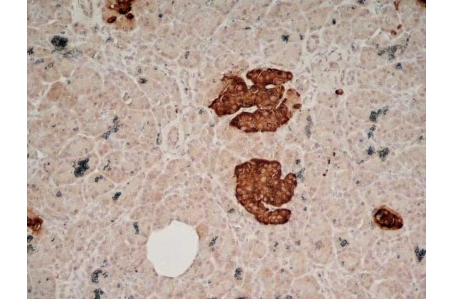 Immunohistochemistry - Anti-Chromogranin A Antibody [LK2H10] (A280876) - Antibodies.com