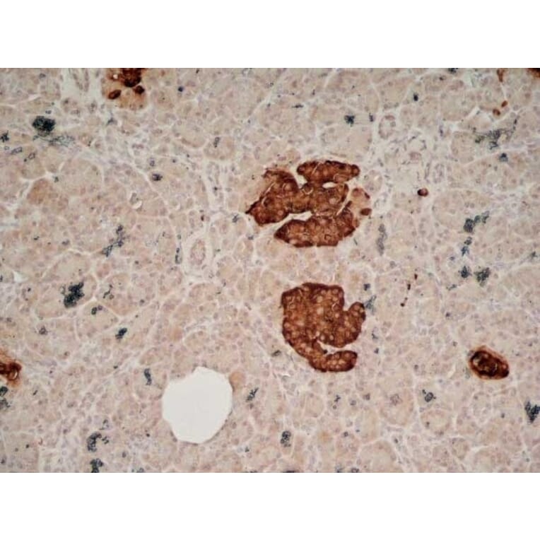 Immunohistochemistry - Anti-Chromogranin A Antibody [LK2H10] (A280876) - Antibodies.com