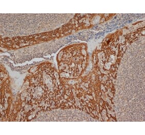 Immunohistochemistry - Anti-Cytokeratin 14 Antibody [LL002] (A280878) - Antibodies.com
