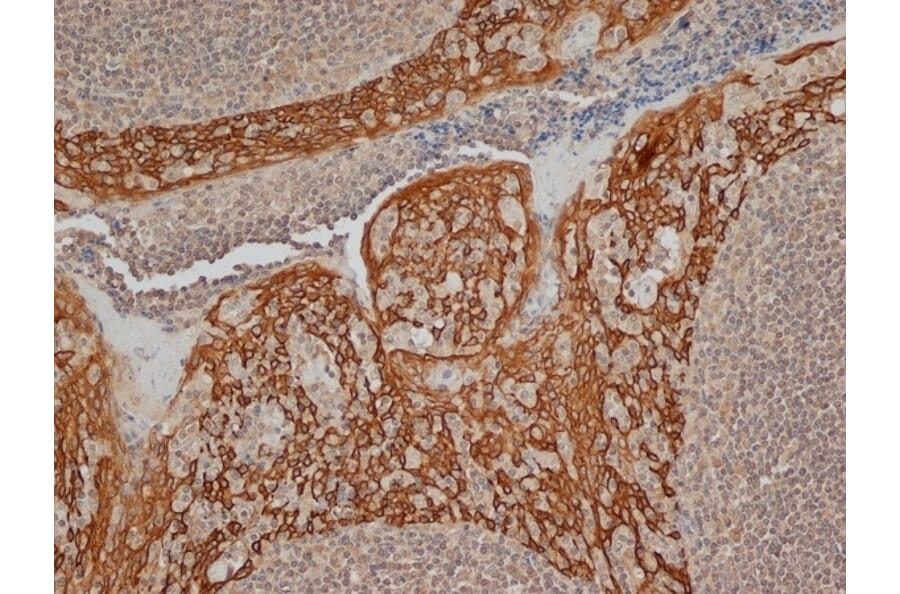 Immunohistochemistry - Anti-Cytokeratin 14 Antibody [LL002] (A280878) - Antibodies.com