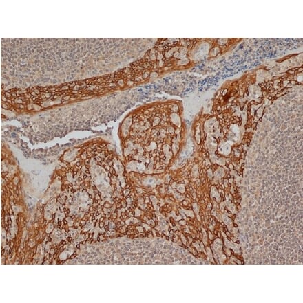 Immunohistochemistry - Anti-Cytokeratin 14 Antibody [LL002] (A280878) - Antibodies.com