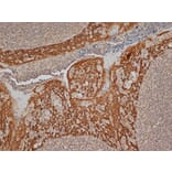 Immunohistochemistry - Anti-Cytokeratin 14 Antibody [LL002] (A280878) - Antibodies.com
