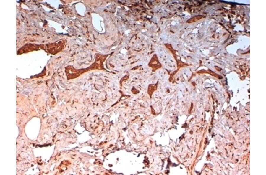 Immunohistochemistry - Anti-Cytokeratin 14 Antibody [LL002] (A280878) - Antibodies.com